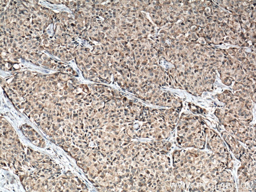 [66737-1-IG-20UL] IL-1 Beta Monoclonal antibody