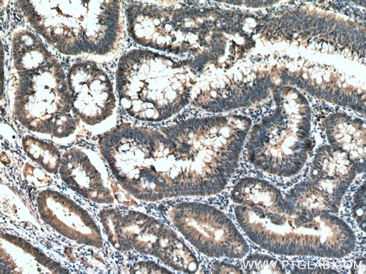 [66744-1-IG-150UL] ATG5 Monoclonal antibody