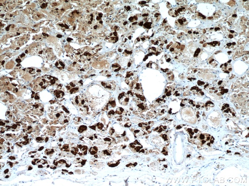 [66750-1-IG-20UL] TSH Beta Monoclonal antibody