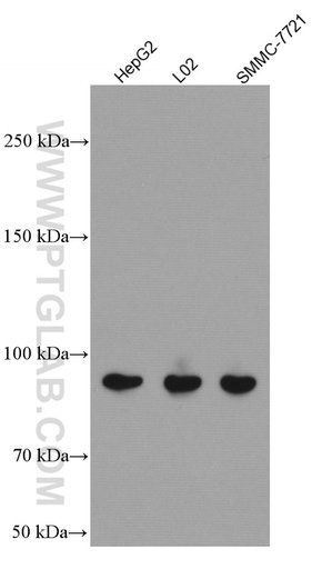 [66752-1-IG-150UL] PLA2G4D Monoclonal antibody