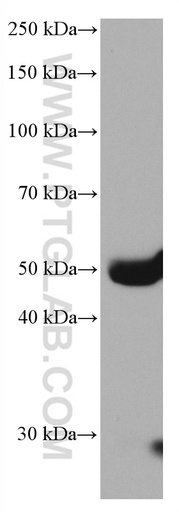 [66753-1-IG-150UL] Factor X Monoclonal antibody