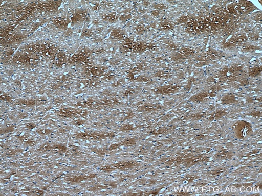 [66758-1-IG-20UL] DKK3 Monoclonal antibody