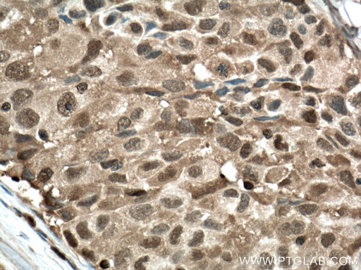 [66759-1-IG-150UL] PSMB8 Monoclonal antibody