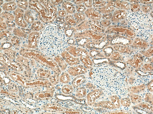 [66760-1-IG-150UL] STX3 Monoclonal antibody