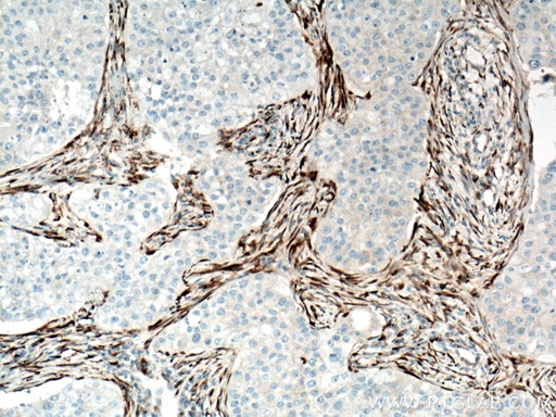 [66761-1-IG-150UL] Collagen Type I Monoclonal antibody