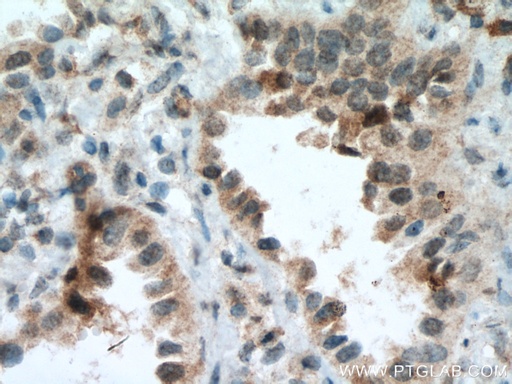 [66762-1-IG-20UL] BACH1 Monoclonal antibody