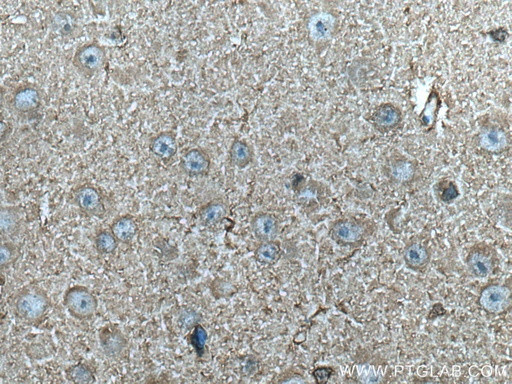 [66764-1-IG-150UL] CKB Monoclonal antibody