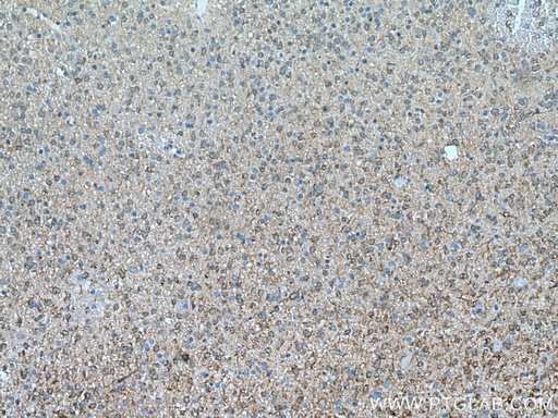 [66767-1-IG-150UL] HSPB1 Monoclonal antibody