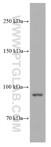 [66769-1-IG-150UL] PYGL Monoclonal antibody