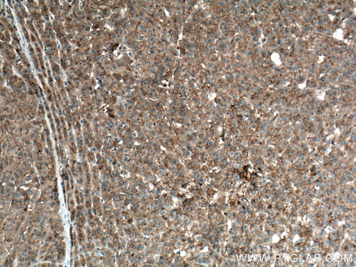 [66773-1-IG-150UL] Apolipoprotein A II Monoclonal antibody