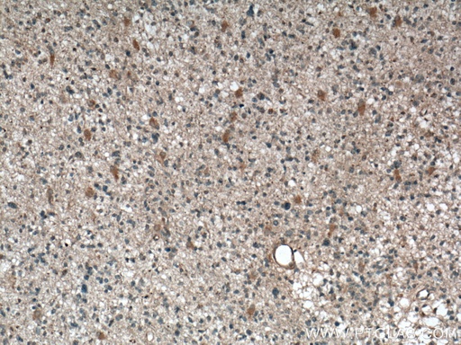 [66781-1-IG-20UL] Neuromedin B Monoclonal antibody