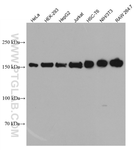 [66782-1-IG-20UL] ROCK1 Monoclonal antibody