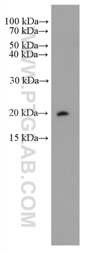 [66784-1-IG-20UL] CD52 Monoclonal antibody