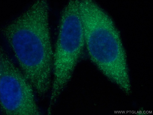 [66785-1-IG-150UL] LACTB Monoclonal antibody