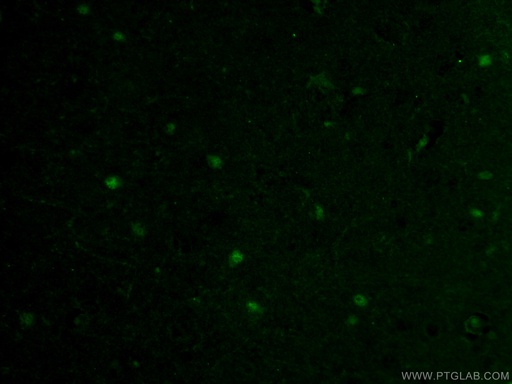 [66786-1-IG-20UL] SOX10 Monoclonal antibody