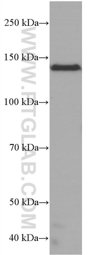 [66790-1-IG-20UL] RGS3 Monoclonal antibody