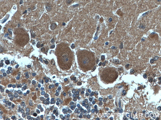 [66791-1-IG-150UL] CDR2L Monoclonal antibody