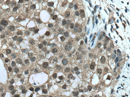 [66792-1-IG-20UL] TRBP Monoclonal antibody
