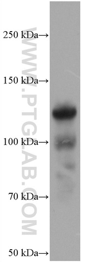 [66793-1-IG-150UL] COMP Monoclonal antibody