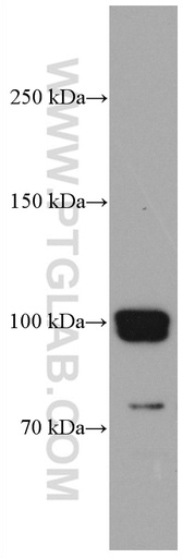 [66796-1-IG-20UL] CNKSR1 Monoclonal antibody