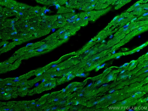 [66797-1-IG-20UL] SOCS3 Monoclonal antibody