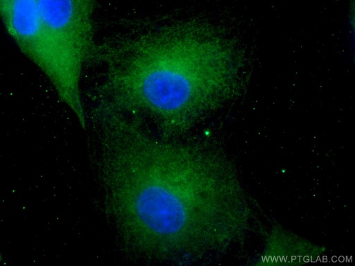 [66798-1-IG-20UL] HPGD Monoclonal antibody