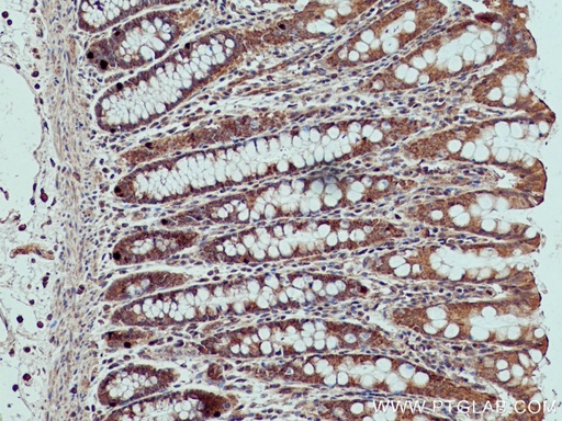 [66800-1-IG-150UL] XIAP Monoclonal antibody