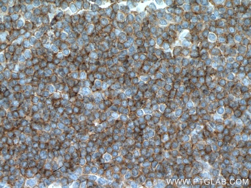 [66801-1-IG-150UL] CCR6 Monoclonal antibody