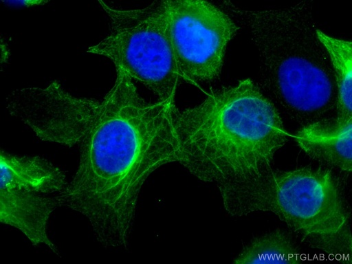 [66802-1-IG-20UL] Cytokeratin 16 Monoclonal antibody