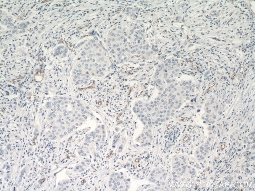 [66804-1-IG-150UL] VE-cadherin Monoclonal antibody