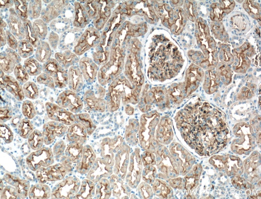 [66805-1-IG-20UL] AQP1 Monoclonal antibody