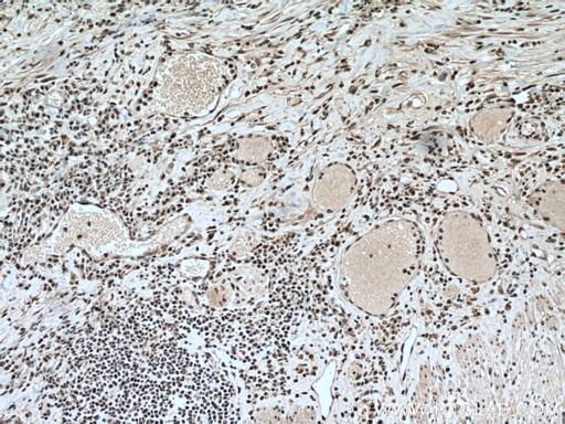 [66807-1-IG-150UL] PABPN1 Monoclonal antibody