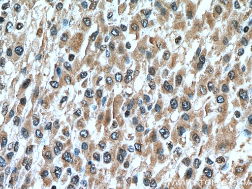 [66808-1-IG-150UL] GCLM Monoclonal antibody