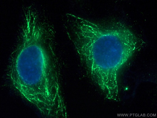 [66811-1-IG-150UL] FFAR3 Monoclonal antibody