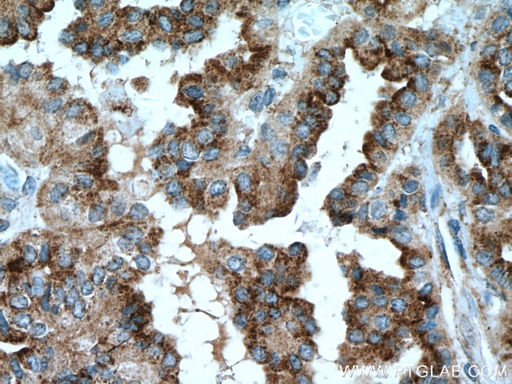 [66813-1-IG-150UL] DIO2 Monoclonal antibody