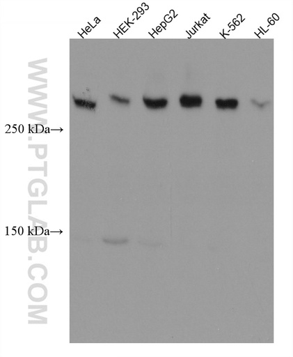[66814-1-IG-20UL] CEP250,C-NAP1 Monoclonal antibody