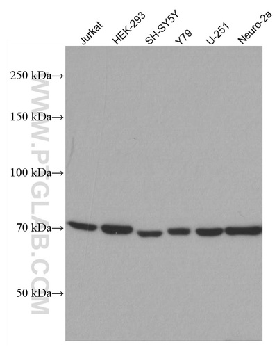 [66816-1-IG-20UL] CHAT Monoclonal antibody