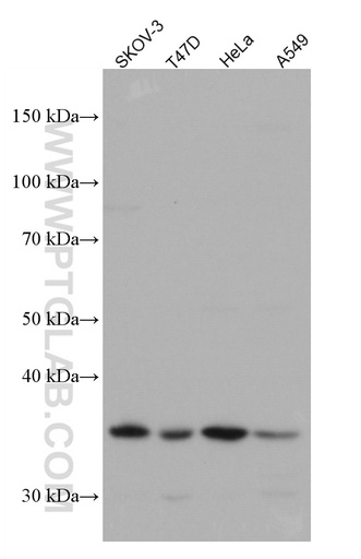 [66817-1-IG-150UL] VTCN1 Monoclonal antibody