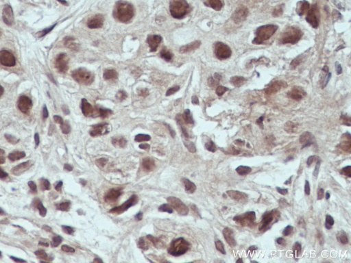 [66822-1-IG-150UL] USP4 Monoclonal antibody