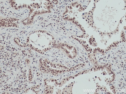 [66823-1-IG-20UL] OGT Monoclonal antibody