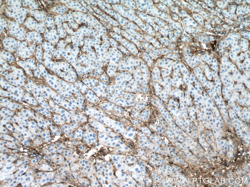 [66824-1-IG-150UL] Collagen Type VI  Monoclonal antibody