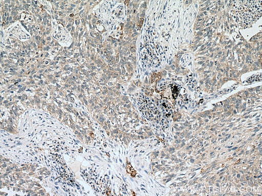 [66828-1-IG-20UL] VEGFA Monoclonal antibody