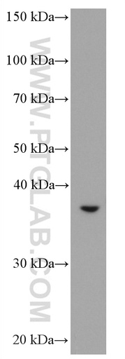 [66831-1-IG-150UL] ASGR2 Monoclonal antibody