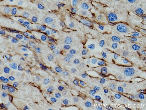 [66834-1-IG-150UL] AOC3 Monoclonal antibody