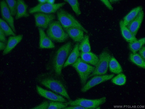 [66837-1-IG-20UL] MBNL1 Monoclonal antibody