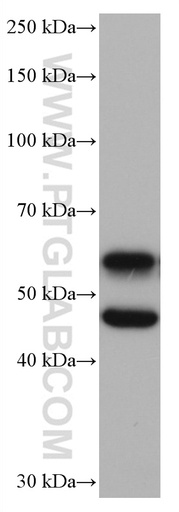 [66843-1-IG-20UL] CAMK2 Monoclonal antibody
