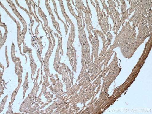 [66846-1-IG-20UL] GLUT4 Monoclonal antibody