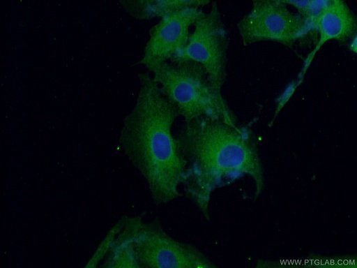 [66849-1-IG-20UL] CPLX2 Monoclonal antibody