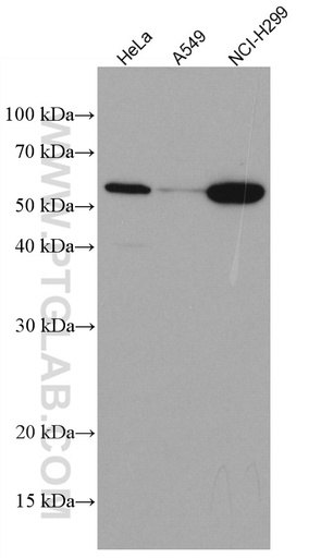 [66850-1-IG-150UL] KLF5 Monoclonal antibody