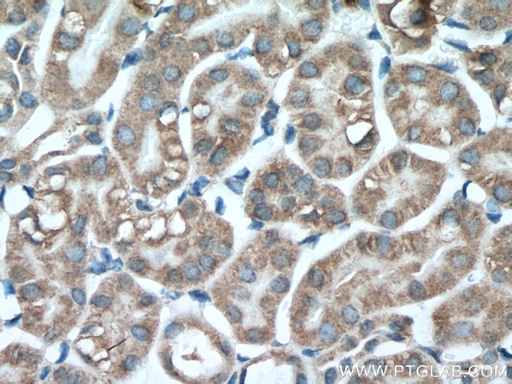 [66862-1-IG-20UL] PCK1 Monoclonal antibody
